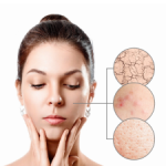 Ảnh trang về KDerm