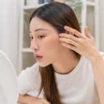 Ảnh trang về KDerm