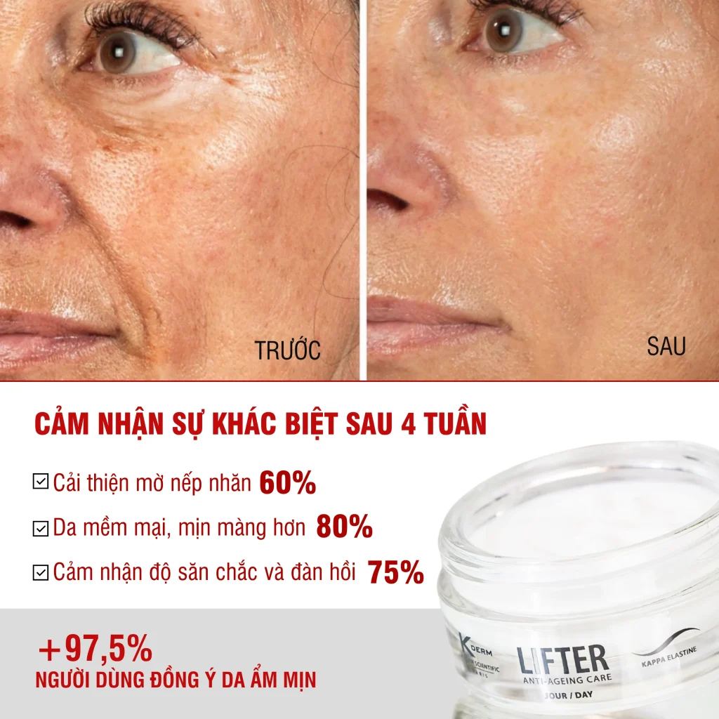 Kem dưỡng ban ngày Lifter Day Cream