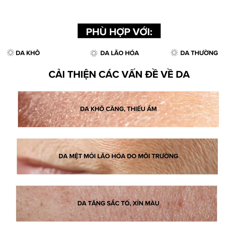 Kem dưỡng ban ngày Lifter Day Cream