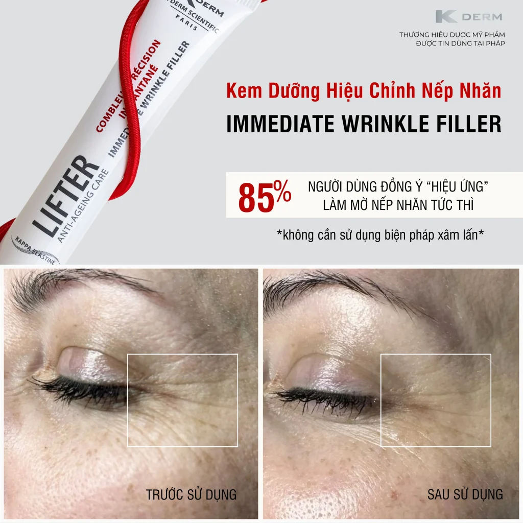 Kem dưỡng mờ nếp nhăn Immediate Filler