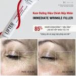 Kem dưỡng mờ nếp nhăn Immediate Filler