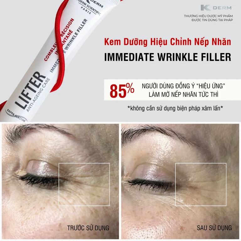 Kem dưỡng mờ nếp nhăn Immediate Filler
