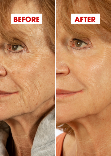 ảnh kết quả lâm sàng