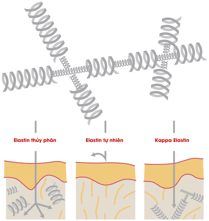 Ảnh trang về Kappa Elastin