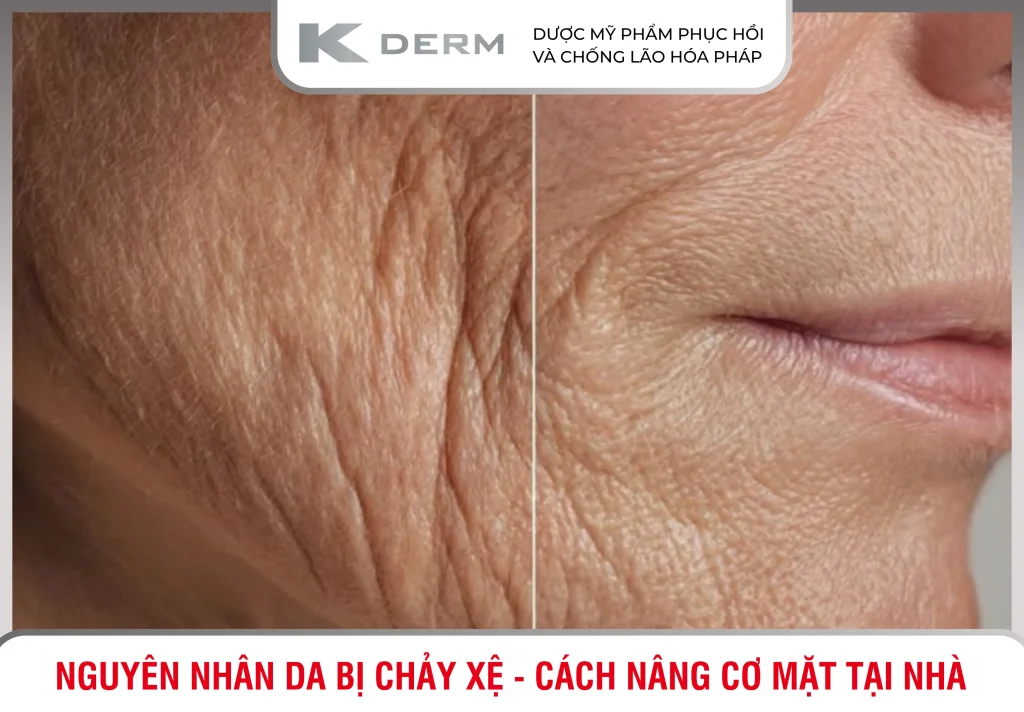 Da bị chảy xệ, da mất đàn hồi